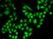 Ran GTPase Activating Protein 1 antibody, LS-C748399, Lifespan Biosciences, Immunofluorescence image 