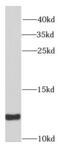 Small Nuclear Ribonucleoprotein Polypeptide E antibody, FNab08076, FineTest, Western Blot image 