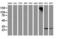 Pyrroline-5-Carboxylate Reductase 3 antibody, LS-C172477, Lifespan Biosciences, Western Blot image 