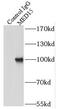 Mediator Complex Subunit 15 antibody, FNab05089, FineTest, Immunoprecipitation image 