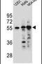 Syncoilin, Intermediate Filament Protein antibody, PA5-24290, Invitrogen Antibodies, Western Blot image 