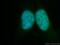 ATP-dependent DNA helicase Q5 antibody, 12468-2-AP, Proteintech Group, Immunofluorescence image 
