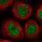 Armadillo Repeat Containing 4 antibody, PA5-58129, Invitrogen Antibodies, Immunofluorescence image 
