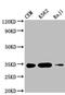 Cytotoxic T-Lymphocyte Associated Protein 4 antibody, CSB-MA006163A0m, Cusabio, Western Blot image 