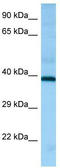 Histamine H2 receptor antibody, TA337999, Origene, Western Blot image 