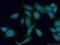 BM-90 antibody, 20425-1-AP, Proteintech Group, Immunofluorescence image 