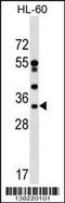 DnaJ Heat Shock Protein Family (Hsp40) Member C17 antibody, 59-556, ProSci, Western Blot image 