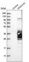 Metabolism Of Cobalamin Associated C antibody, PA5-55596, Invitrogen Antibodies, Western Blot image 