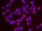 RecQ Mediated Genome Instability 1 antibody, NB100-1720, Novus Biologicals, Proximity Ligation Assay image 