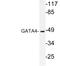GATA Binding Protein 4 antibody, LS-C176597, Lifespan Biosciences, Western Blot image 