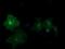 cGMP-dependent 3 ,5 -cyclic phosphodiesterase antibody, NBP2-03598, Novus Biologicals, Immunocytochemistry image 