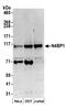 NEDD4 Binding Protein 1 antibody, A304-628A, Bethyl Labs, Western Blot image 
