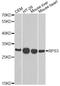 Ribosomal Protein S3 antibody, LS-C748588, Lifespan Biosciences, Western Blot image 