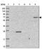 Zinc Finger Protein 623 antibody, PA5-60692, Invitrogen Antibodies, Western Blot image 