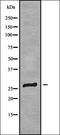Catenin Delta 2 antibody, orb338144, Biorbyt, Western Blot image 