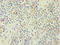 ATP Binding Cassette Subfamily F Member 2 antibody, LS-C379532, Lifespan Biosciences, Immunohistochemistry paraffin image 