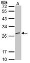 Eukaryotic translation initiation factor 3 subunit K antibody, TA308505, Origene, Western Blot image 