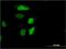 Retinol Dehydrogenase 12 antibody, H00145226-M01, Novus Biologicals, Immunofluorescence image 