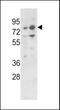 Zinc Finger And BTB Domain Containing 16 antibody, 62-387, ProSci, Western Blot image 