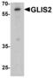 Zinc finger protein GLIS2 antibody, PA5-72849, Invitrogen Antibodies, Western Blot image 