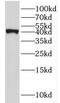 Interleukin 10 Receptor Subunit Beta antibody, FNab04214, FineTest, Western Blot image 