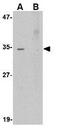 Akirin 2 antibody, GTX17015, GeneTex, Western Blot image 