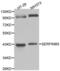 Serpin B5 antibody, LS-C192435, Lifespan Biosciences, Western Blot image 