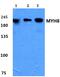 Myosin Heavy Chain 8 antibody, PA5-37180, Invitrogen Antibodies, Western Blot image 