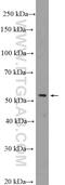 DEAD-Box Helicase 49 antibody, 20523-1-AP, Proteintech Group, Western Blot image 