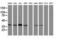 MAGE Family Member B1 antibody, M13984, Boster Biological Technology, Western Blot image 