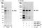 ABL Proto-Oncogene 2, Non-Receptor Tyrosine Kinase antibody, A301-986A, Bethyl Labs, Immunoprecipitation image 