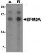 Laforin antibody, TA319742, Origene, Western Blot image 