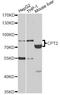Carnitine O-palmitoyltransferase 2, mitochondrial antibody, MBS128147, MyBioSource, Western Blot image 