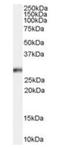 Homeobox protein Hox-B13 antibody, orb19349, Biorbyt, Western Blot image 