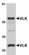 Protein kinase domain-containing protein, cytoplasmic antibody, LS-B5068, Lifespan Biosciences, Western Blot image 
