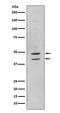 Mitogen-Activated Protein Kinase 8 antibody, P02608, Boster Biological Technology, Western Blot image 