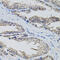 FAS antibody, LS-C330859, Lifespan Biosciences, Immunohistochemistry paraffin image 