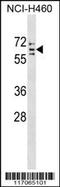 Cytochrome P450 Family 4 Subfamily V Member 2 antibody, 59-271, ProSci, Western Blot image 