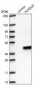 Kelch Domain Containing 9 antibody, NBP2-48547, Novus Biologicals, Western Blot image 