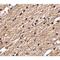 Sprouty Related EVH1 Domain Containing 3 antibody, LS-C82865, Lifespan Biosciences, Immunohistochemistry paraffin image 