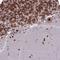 DEAD-Box Helicase 1 antibody, HPA034502, Atlas Antibodies, Immunohistochemistry frozen image 