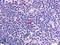 C-X-C Motif Chemokine Receptor 5 antibody, LS-A1384, Lifespan Biosciences, Immunohistochemistry paraffin image 