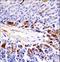 Pseudopodium-enriched atypical kinase 1 antibody, LS-C164576, Lifespan Biosciences, Immunohistochemistry paraffin image 