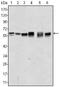 AKT Serine/Threonine Kinase 2 antibody, AM06381SU-N, Origene, Western Blot image 