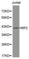 RP2 Activator Of ARL3 GTPase antibody, MBS127851, MyBioSource, Western Blot image 