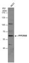 Protein Phosphatase 2 Regulatory Subunit B'Beta antibody, GTX117756, GeneTex, Western Blot image 
