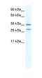 Olfactory Receptor Family 13 Subfamily C Member 5 antibody, orb324403, Biorbyt, Western Blot image 