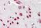 Neuro-oncological ventral antigen 1 antibody, MBS242506, MyBioSource, Immunohistochemistry paraffin image 