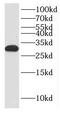 Potassium Channel Tetramerization Domain Containing 14 antibody, FNab04504, FineTest, Western Blot image 