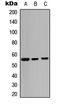 MDM2 Proto-Oncogene antibody, LS-C368433, Lifespan Biosciences, Western Blot image 